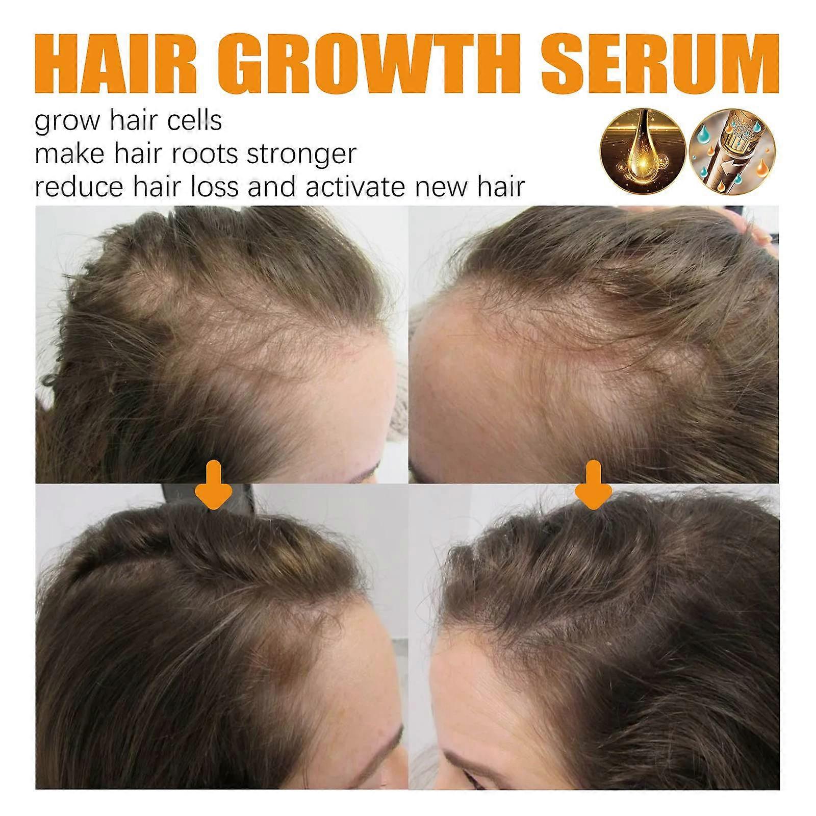 Hair Growth Essential Oil